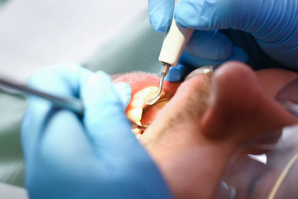 Best Dentist for Dental Trauma  in Eldora, IA